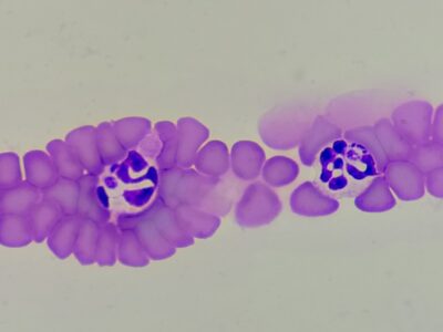 anaplazmoza