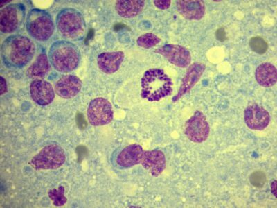 Biopsja - figura mitotyczna